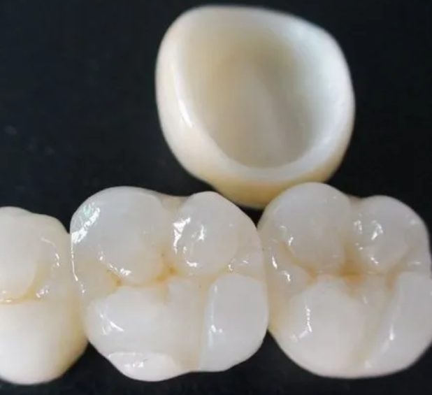 Zirconia Crown
